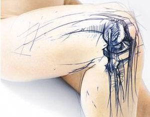 Orthopedics